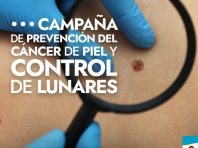 SALUD: CAMPAÑA DE CONTROL DE LUNARES Y PREVENCIÓN DEL CÁNCER DE PIEL EN EL HOSPITAL MUNICIPAL