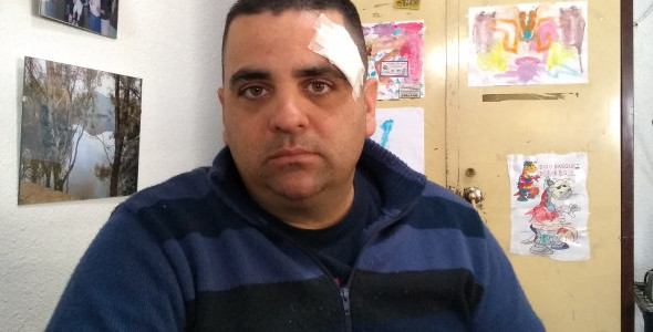 Fue agredido por su vecino por pedirle que bajara la música