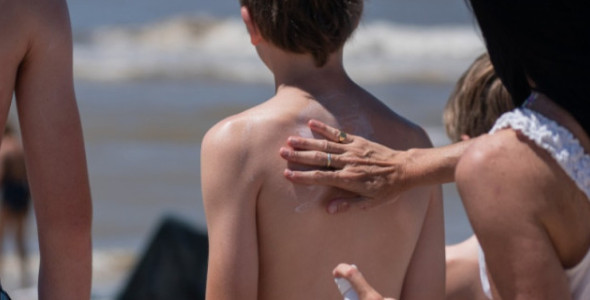 RECOMENDACIONES PARA EVITAR EFECTOS DAÑINOS DEL SOL EN LA PIEL